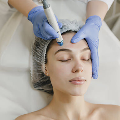 diferencias_microdermabrasion_hidrodermoabrasion